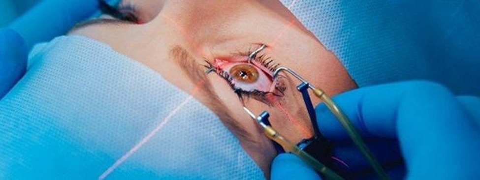 About LASIK